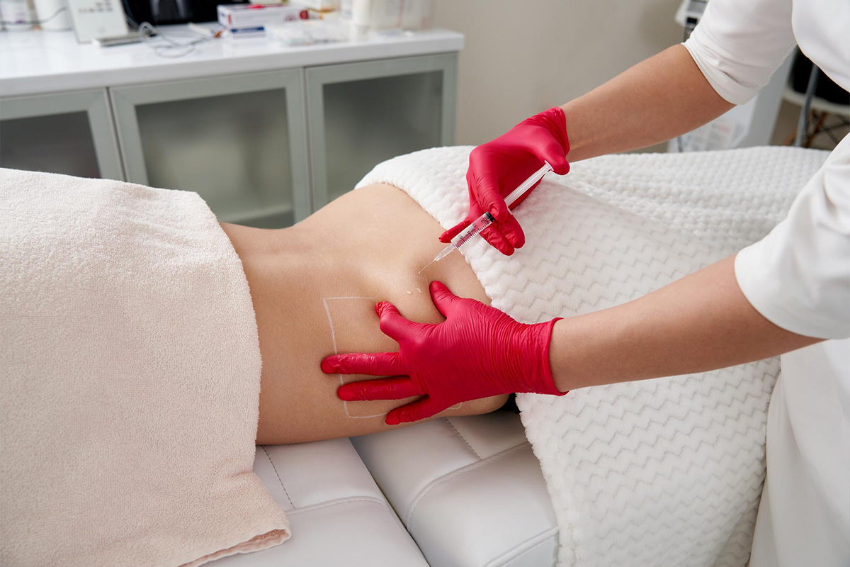 Poliklinika Beograd | Liposukcija leđa